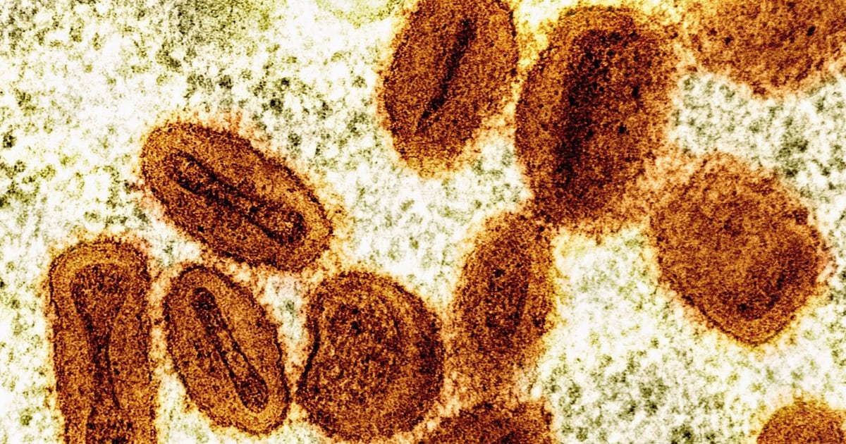 Toronto Public Health Warns Mpox Is Making a Comeback